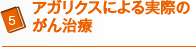 アガリクスによる実際のがん治療